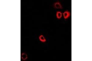 Immunofluorescent analysis of PTPS staining in MCF7 cells. (PTS antibody)