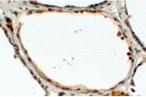 Immunohistochemistry (IHC) image for anti-Dual Oxidase 1 (DUOX1) (Internal Region) antibody (ABIN2465619) (DUOX1 antibody  (Internal Region))