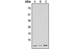 Western blot analysis of NDUFB1 expression in HeLa (A), Raw264. (NDUFB1 antibody  (N-Term))