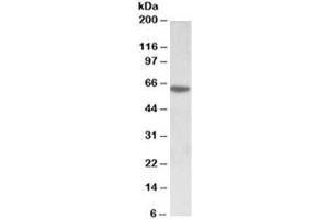 Western blot testing of MOLT4 lysate with SOX11 antibody at 0. (SOX11 antibody)