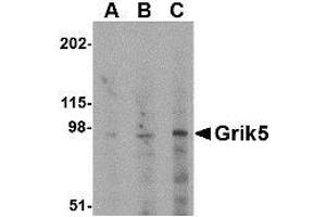 Western blot analysis of Grik5 in human brain tissue lysate with AP30386PU-N Grik5 antibody at (A) 0. (GRIK5 antibody  (C-Term))
