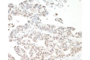 Immunohistochemistry (IHC) image for anti-Interleukin enhancer-binding factor 3 (ILF3) (AA 456-506) antibody (ABIN7453567) (Interleukin enhancer-binding factor 3 (ILF3) (AA 456-506) antibody)