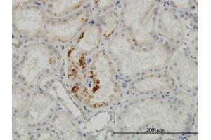 Image no. 2 for anti-Endothelial Cell-Specific Molecule 1 (ESM1) (AA 85-185) antibody (ABIN466176) (ESM1 antibody  (AA 85-185))