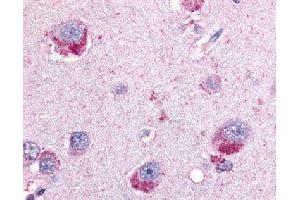 Immunohistochemical (Formalin/PFA-fixed paraffin-embedded sections) staining in human brain with PYGB polyclonal antibody . (PYGB antibody)