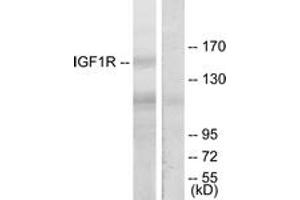 Western blot analysis of extracts from 293 cells, treated with Insulin, using IGF1R (Ab-1165/1166) Antibody. (IGF1R antibody  (AA 1131-1180))