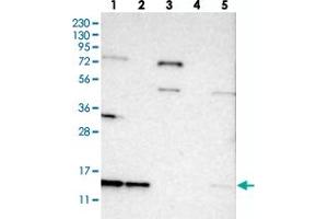 Western blot analysis of Lane 1: RT-4, Lane 2: U-251 MG, Lane 3: Human Plasma, Lane 4: Liver, Lane 5: Tonsil with SNRPD3 polyclonal antibody  at 1:250-1:500 dilution.