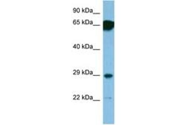 SNRPN 抗体  (AA 46-95)