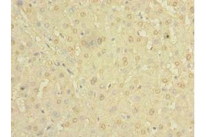 Immunohistochemistry of paraffin-embedded human liver tissue using ABIN7154980 at dilution of 1:100 (Hemoglobin, epsilon 1 (HBe1) (AA 2-147) antibody)