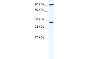 WB Suggested Anti-PAntibody Titration:  0. (PARP16 antibody  (N-Term))
