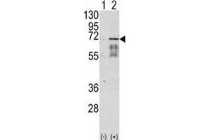 Western Blotting (WB) image for anti-Activin Receptor Type I (ACRV1) antibody (ABIN3002992) (ACVR1 antibody)