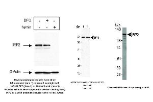 Image no. 5 for anti-Iron-Responsive Element Binding Protein 2 (IREB2) antibody (ABIN363497) (IREB2 antibody)