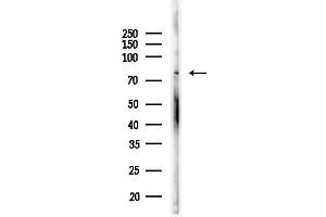 Western blot analysis of lysates from COLO205 cells(LPS, 4h treatment), using eIF2B epsilon Antibody at 1/1000 dilution.