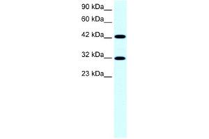 WB Suggested Anti-GTF2H2 Antibody Titration:  0. (GTF2H2 antibody  (Middle Region))