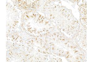 Immunohistochemistry (IHC) image for anti-Tubulin, beta (TUBB) (AA 1-50) antibody (ABIN7453995) (Recombinant TUBB antibody  (AA 1-50))