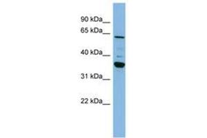 Image no. 1 for anti-Cytochrome P450, Family 3, Subfamily A, Polypeptide 7 (CYP3A7) (C-Term) antibody (ABIN6741776) (CYP3A7 antibody  (C-Term))
