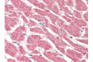 Human Heart (formalin-fixed, paraffin-embedded) stained with LGI4at 5 µg/ml followed by biotinylated goat anti-rabbit IgG secondary antibody, alkaline phosphatase-streptavidin and chromogen. (LGI4 antibody)