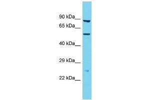 Western Blotting (WB) image for anti-Transmembrane Protease, Serine 9 (TMPRSS9) (N-Term) antibody (ABIN2790876) (TMPRSS9 antibody  (N-Term))