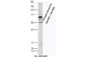 Mouse intestine lysates probed with Rabbit Anti-Smad1/5 (Ser463+Ser465) Polyclonal Antibody, Unconjugated (ABIN746033) at 1:300 overnight at 4˚C. (Smad1/5 antibody  (pSer463, pSer465))