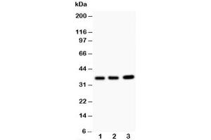 Western Blotting (WB) image for anti-Tumor Necrosis Factor, alpha-Induced Protein 1 (Endothelial) (TNFAIP1) (N-Term) antibody (ABIN3029380)
