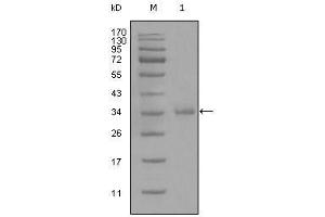 Western Blot showing anti-CD45 monoclonal antibody used against truncated CD45 recombinant protein (1). (CD45 antibody)