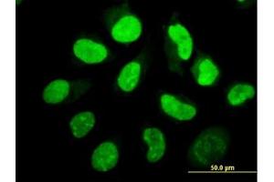 Image no. 4 for anti-Eukaryotic Translation Initiation Factor 2-alpha Kinase 2 (EIF2AK2) (AA 1-101) antibody (ABIN598901) (EIF2AK2 antibody  (AA 1-101))