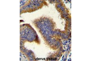 CCNB1 Antibody (C-term) immunohistochemistry analysis in formalin fixed and paraffin embedded human uterus tissue followed by peroxidase conjugation of the secondary antibody and DAB staining. (Cyclin B1 antibody  (C-Term))