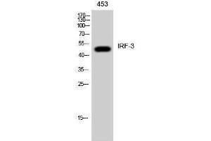 Western Blotting (WB) image for anti-Interferon Regulatory Factor 3 (IRF3) (Ser605) antibody (ABIN3185227) (IRF3 antibody  (Ser605))