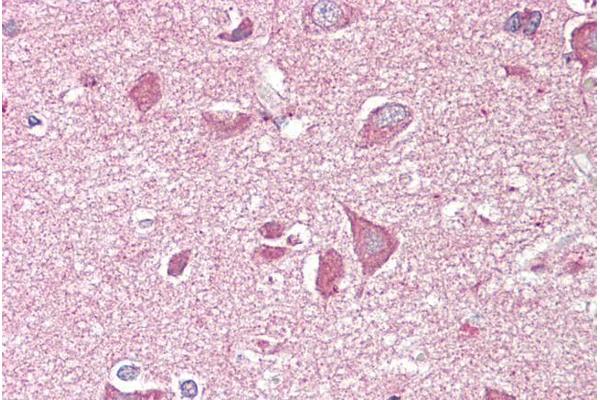 NCAM2 antibody  (C-Term)