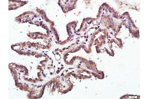 RAPTOR antibody  (AA 101-200)