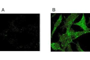 Immunocytochemistry showing the detection of Tollip in Tollip -/- (A) or overexpressed Tollip in -/- (B) murine embryonic fibroblasts (MEF) cells with the MAb to Tollip (Kimmy-2) . (TOLLIP antibody  (AA 1-274))