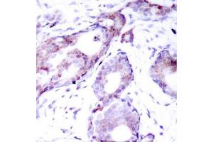 Immunohistochemistry (IHC) image for anti-Myc Proto-Oncogene protein (MYC) (pSer373) antibody (ABIN3019599) (c-MYC antibody  (pSer373))
