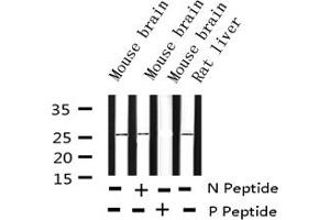 Western blot analysis of Phospho-eIF4E (Ser209) expression in various lysates (EIF4E antibody  (pSer209))
