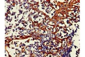Immunohistochemistry of paraffin-embedded human tonsil tissue using ABIN7160758 at dilution of 1:100 (FPR3 antibody  (AA 307-353))