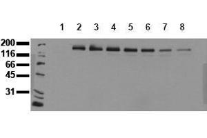 Western Blotting (WB) image for anti-Receptor tyrosine-protein kinase erbB-2 (ErbB2/Her2) (pTyr1248) antibody (ABIN126792) (ErbB2/Her2 antibody  (pTyr1248))