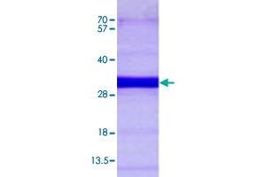 Image no. 1 for RAB21, Member RAS Oncogene Family (RAB21) (AA 18-222) protein (His tag) (ABIN5569822)