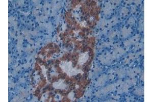 Immunohistochemistry (IHC) image for anti-Endothelin 1 (EDN1) (AA 33-202) antibody (ABIN7429730)