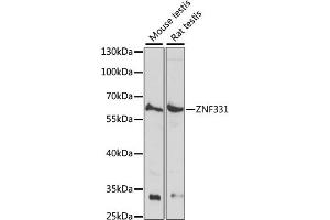 Western blot analysis of extracts of various cell lines, using ZNF331 antibody (ABIN7271477) at 1:1000 dilution. (ZNF331 antibody  (AA 50-130))
