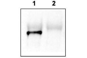 Mouse brain lysate was immunoprecipitated with anti-Tamalin antiserum. (Tamalin/GRASP antibody)