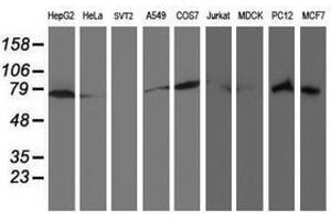 Image no. 4 for anti-Ribophorin 1 (RPN1) antibody (ABIN1500748)