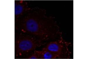 Image no. 1 for anti-Paxillin (PXN) (pTyr88) antibody (ABIN401592) (Paxillin antibody  (pTyr88))