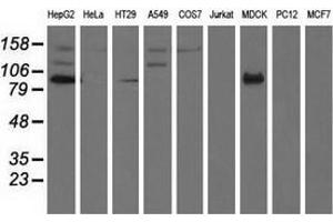 Western blot analysis of extracts (35 µg) from 9 different cell lines by using anti-ALDH1L1 monoclonal antibody. (ALDH1L1 antibody)