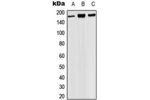 Western blot analysis of PHLPP expression in HEK293T (A), SP2/0 (B), PC12 (C) whole cell lysates. (PHLPP1 antibody  (C-Term))