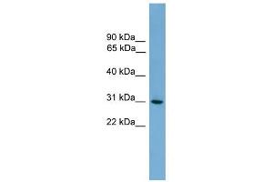 HLA-DQA2 antibody used at 1 ug/ml to detect target protein.