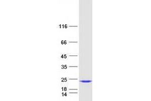 Validation with Western Blot (IL1F10 Protein (Transcript Variant 1) (Myc-DYKDDDDK Tag))