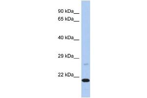 Western Blotting (WB) image for anti-Protoporphyrinogen Oxidase (PPOX) (C-Term) antibody (ABIN2786510) (PPOX antibody  (C-Term))