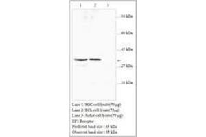 Image no. 1 for anti-Prostaglandin E Receptor 3 (Subtype EP3) (PTGER3) antibody (ABIN791349) (PTGER3 antibody)