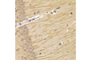Immunohistochemistry of paraffin-embedded Mouse brain using TCN2 antibody at dilution of 1:100 (x400 lens). (TCN2 antibody)