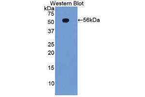 Western Blotting (WB) image for anti-Integrin beta 2 (ITGB2) (AA 124-363) antibody (ABIN1859504) (Integrin beta 2 antibody  (AA 124-363))