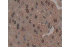 Used in DAB staining on fromalin fixed paraffin- embedded Kidney tissue (PLCB3 antibody  (AA 318-468))