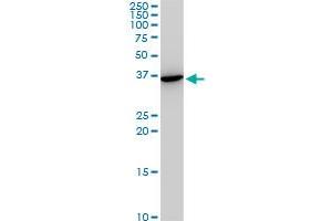 SNAI2 monoclonal antibody (M05), clone 3C12. (SLUG antibody  (AA 97-169))